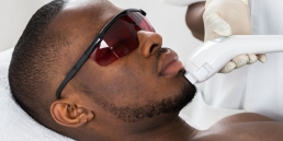 Tratamentos a laser para homens e mulheres