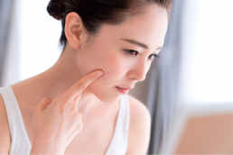 Tratamento e Prevenção da Acne